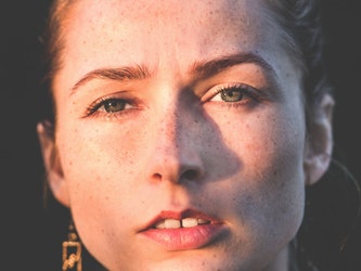 Skin Pigmentation Featured Image