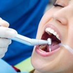 Are Dental Implants Better Than Dentures?