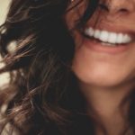 5 Dental Issues That Can Be Treated with Veneers