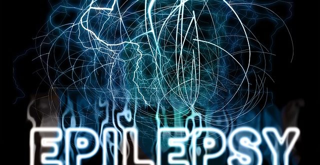 Epilepsy