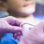 10 Things To Consider Before Getting Dental Implants