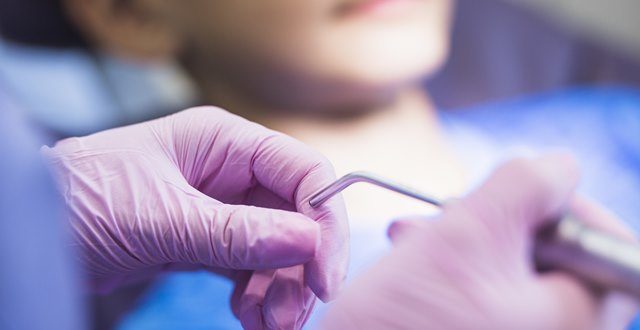 Getting Dental Implants