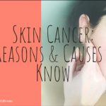 Skin Cancer: 7 Reasons & Causes to Know