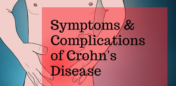Crohn's Disease