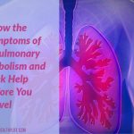 Know the Symptoms of a Pulmonary Embolism and Seek Help Before You Travel