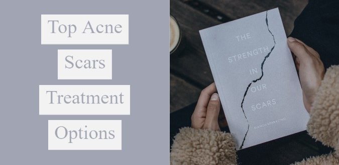 Top Acne Scars Treatment Options