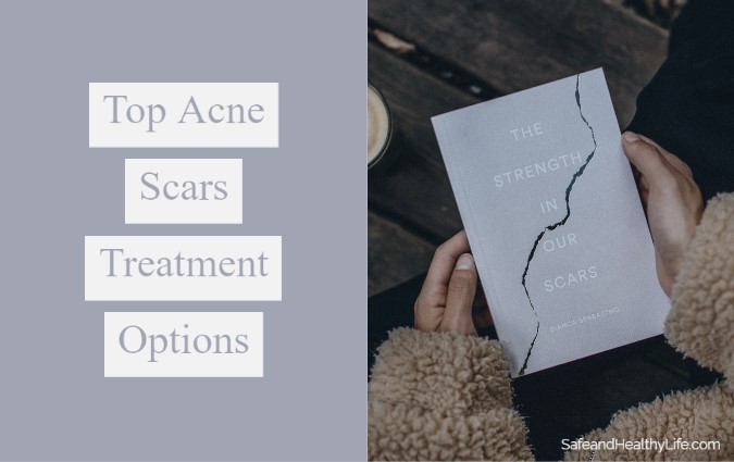 Top Acne Scars Treatment Options