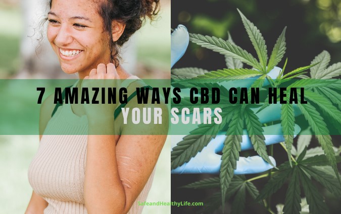 CBD Can Heal Your Scars