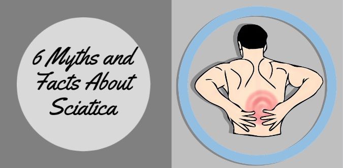 Myths and Facts About Sciatica