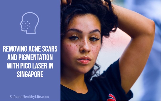 Removing Acne Scars and Pigmentation
