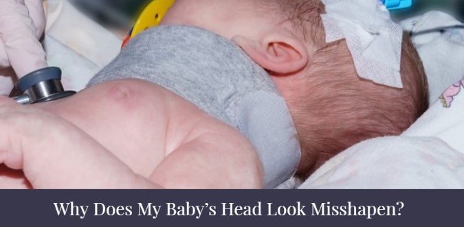 My Baby's Head Look Misshapen