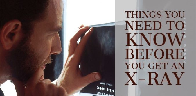 information about X-ray