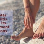 Plantar Fasciitis and Its Treatment Options