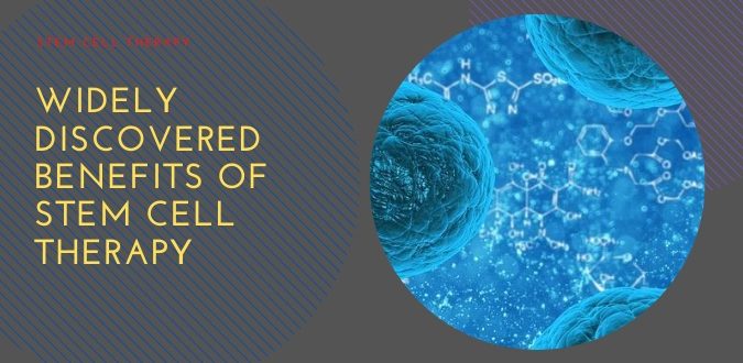 Stem Cell Therapy