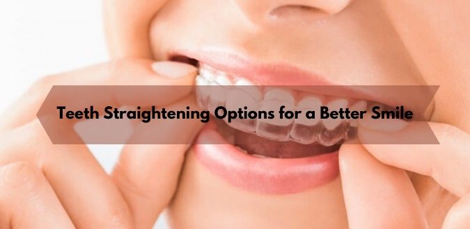 Teeth Straightening Options for a Better Smile
