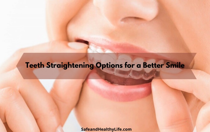 Teeth Straightening Options for a Better Smile