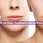Guide To Lip Filler Treatment