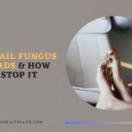 How Nail Fungus Spreads & How to Stop It