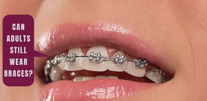 Wear Braces