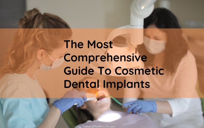 The Most Comprehensive Guide To Cosmetic Dental Implants