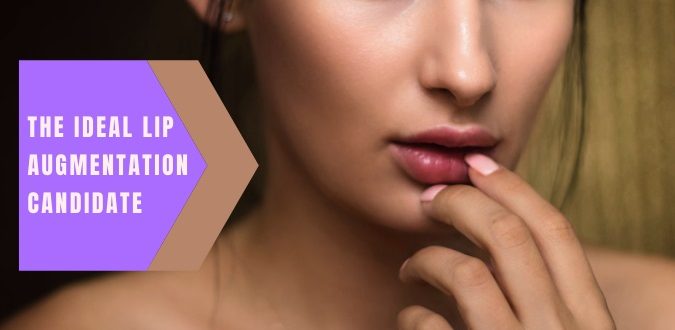 Lip Augmentation Candidate