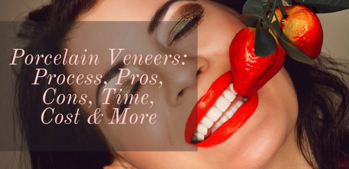 Porcelain Veneers