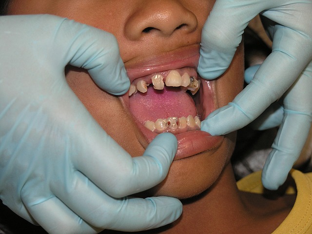 Different Cosmetic Dental Treatments