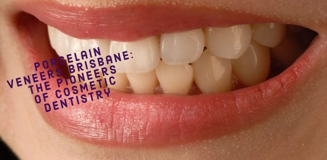 Porcelain Veneers Brisbane
