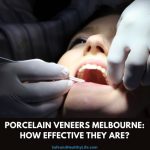 Porcelain Veneers Melbourne: How Effective They Are?