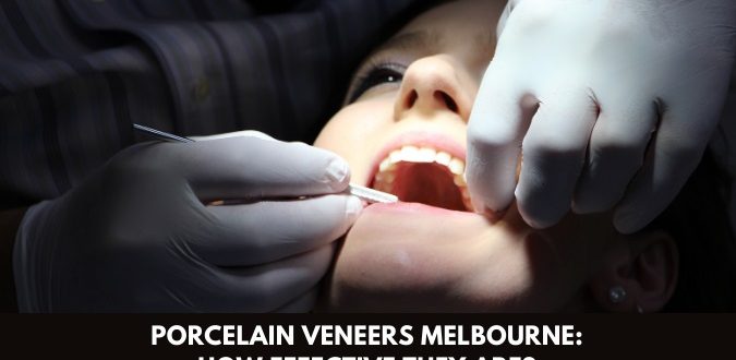 Porcelain Veneers Melbourne