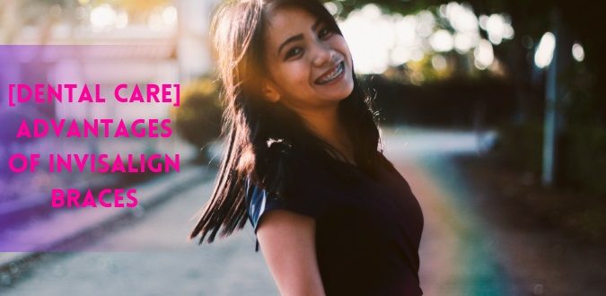 Advantages of Invisalign Braces