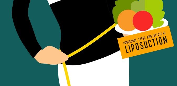 Effects of Liposuction