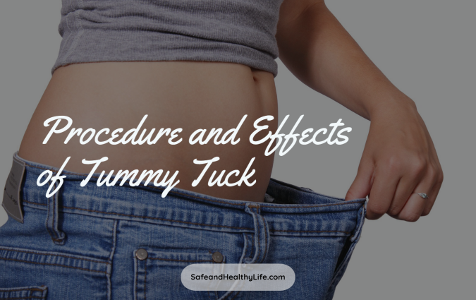 Effects of Tummy Tuck