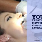 Your Treatment Options After a Tooth Extraction