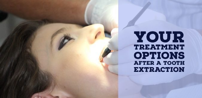 Tooth Extraction