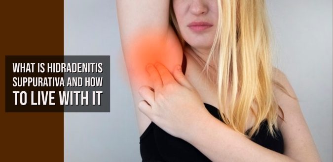 Hidradenitis Suppurativa