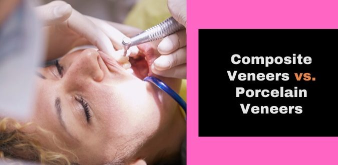 Composite Veneers vs. Porcelain Veneers