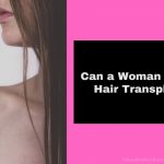 Can a Woman Have a Hair Transplant?
