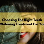 Choosing The Right Teeth Whitening Treatment For You