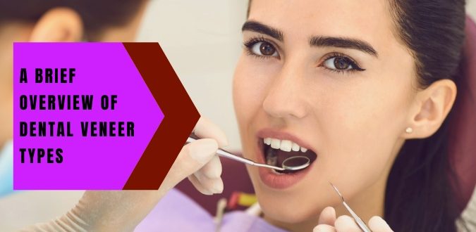 Dental Veneer Types