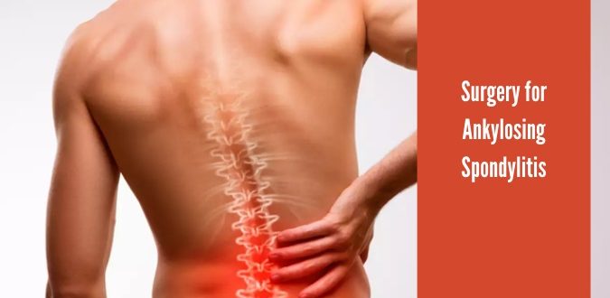 Surgery for Ankylosing Spondylitis