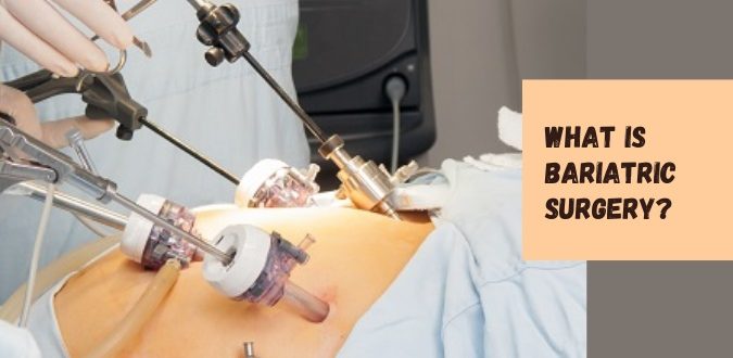 What is Bariatric Surgery