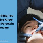 Everything You Need to Know About Porcelain Veneers
