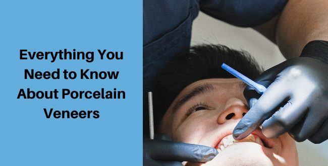 Know About Porcelain Veneers