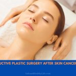 Reconstructive Plastic Surgery After Skin Cancer Removal