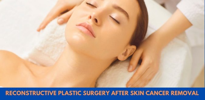 Reconstructive Plastic Surgery