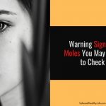 Warning Signs of Moles You May Need to Check