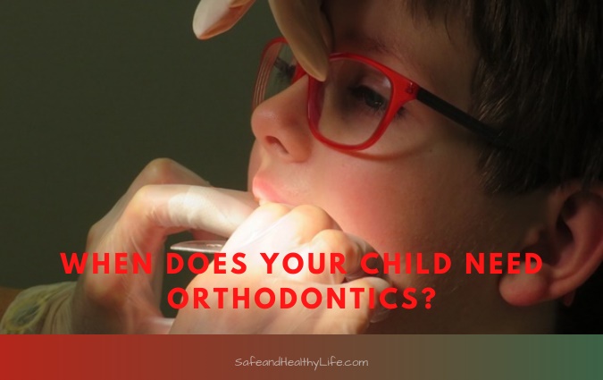 Child need Orthodontics