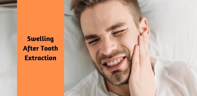 Swelling After Tooth Extraction