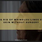 Getting Rid of Wrinkles/Lines on Your Skin Without Surgery